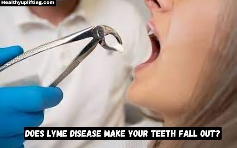 Does Lyme Disease Make Your Teeth Fall Out