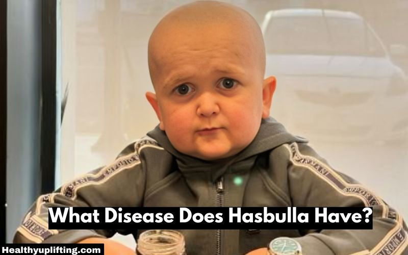 What Disease Does Hasbulla Have