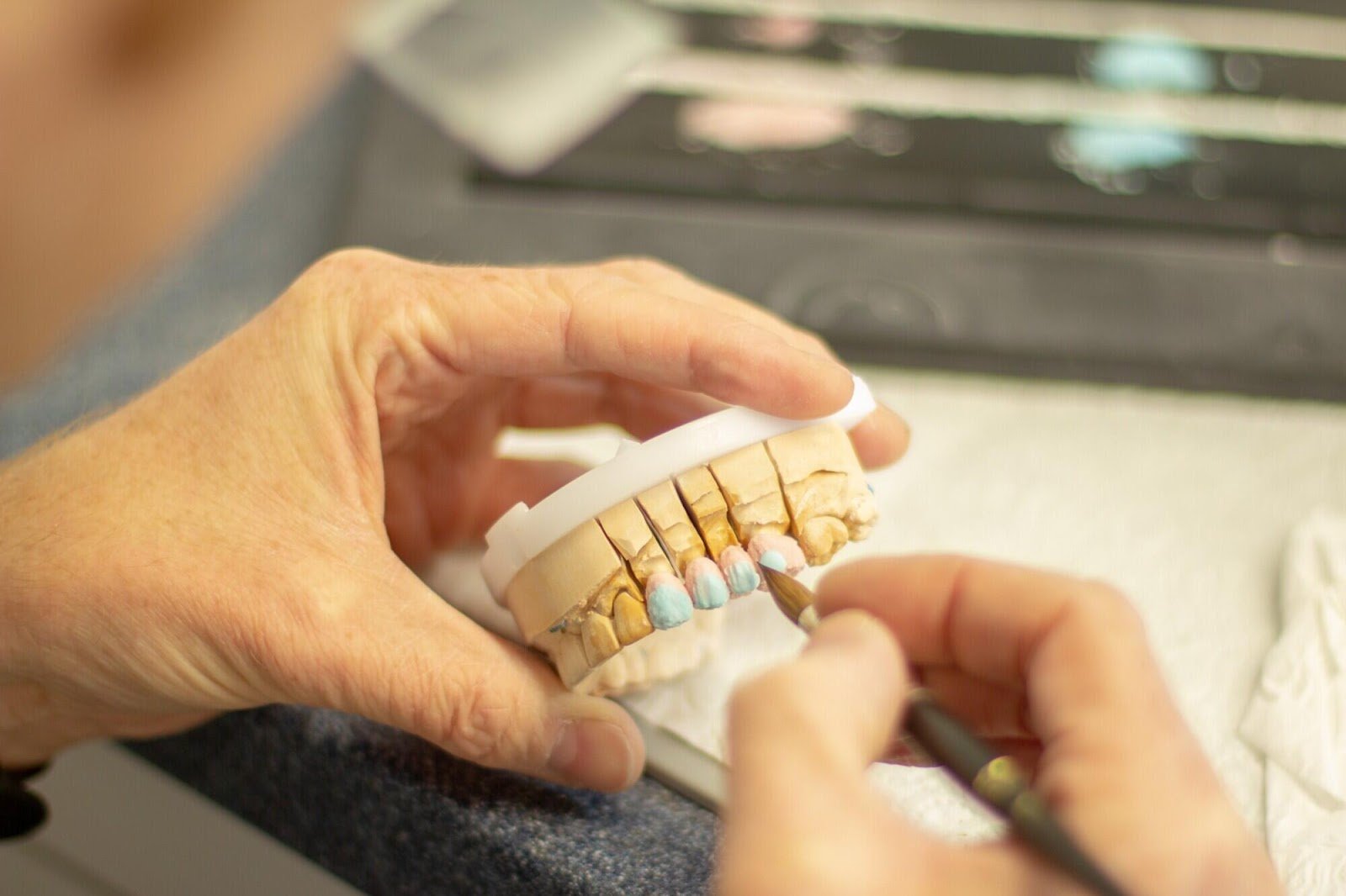 The Pros and Cons of Different Options for Missing Teeth Explained