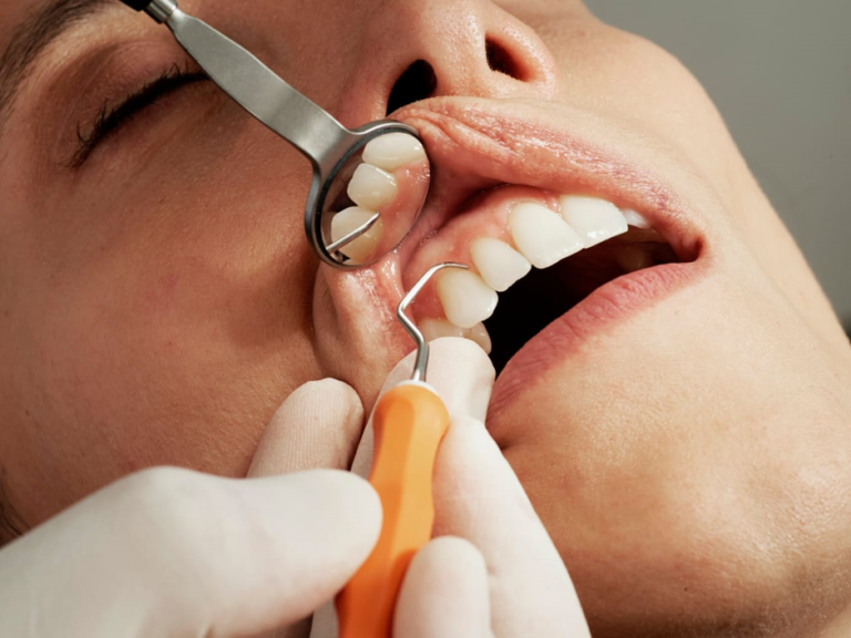 How Periodontal Cleaning Can Prevent Gum Disease and Tooth Loss