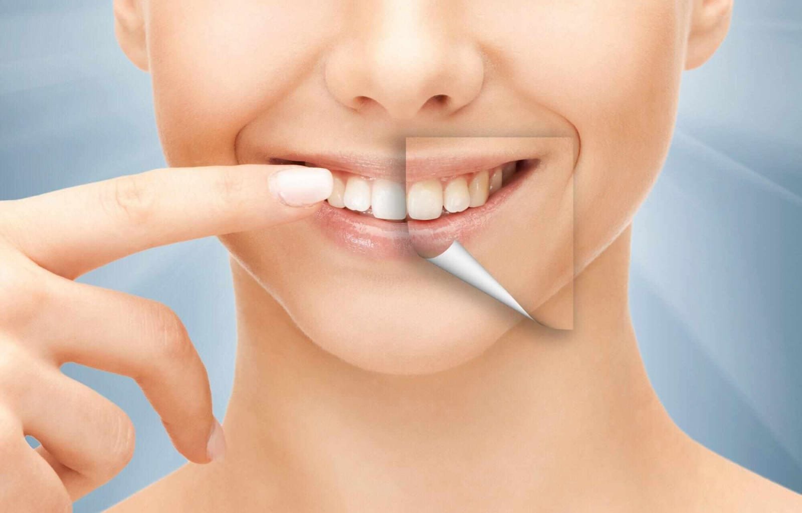 Aesthetic Benefits of Tooth Implant Cosmetic