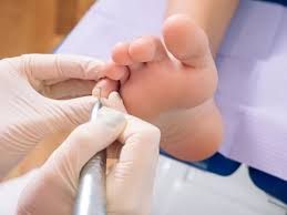 Why Seeing a Podiatrist Matters: Keeping Your Feet Healthy in the Sutherland Shire